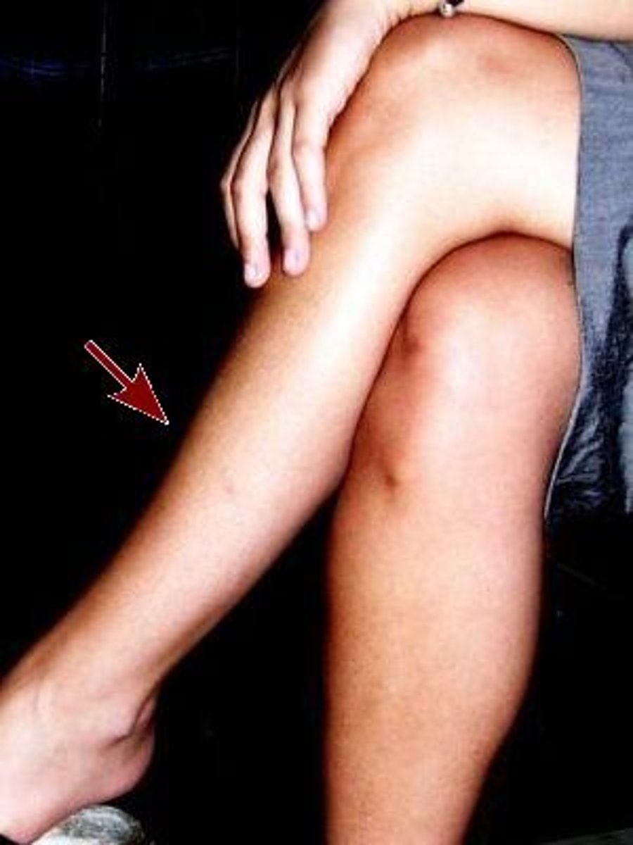 <p>Shin</p>