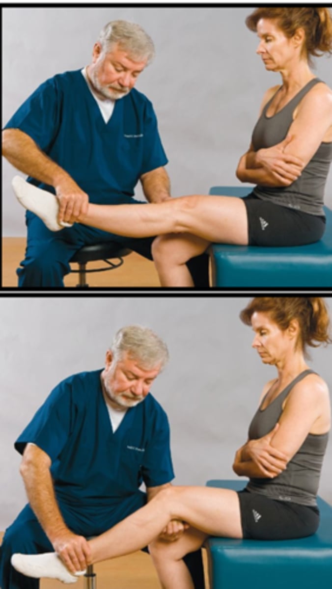 <p>The Deyerle Sign is present if _____ symptoms are present</p>