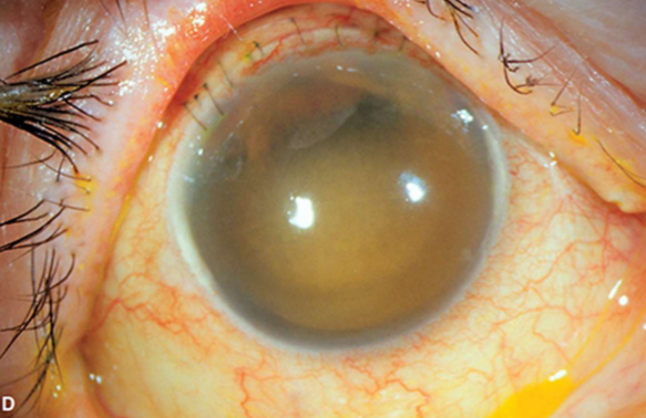 <p>What condition is this?</p>