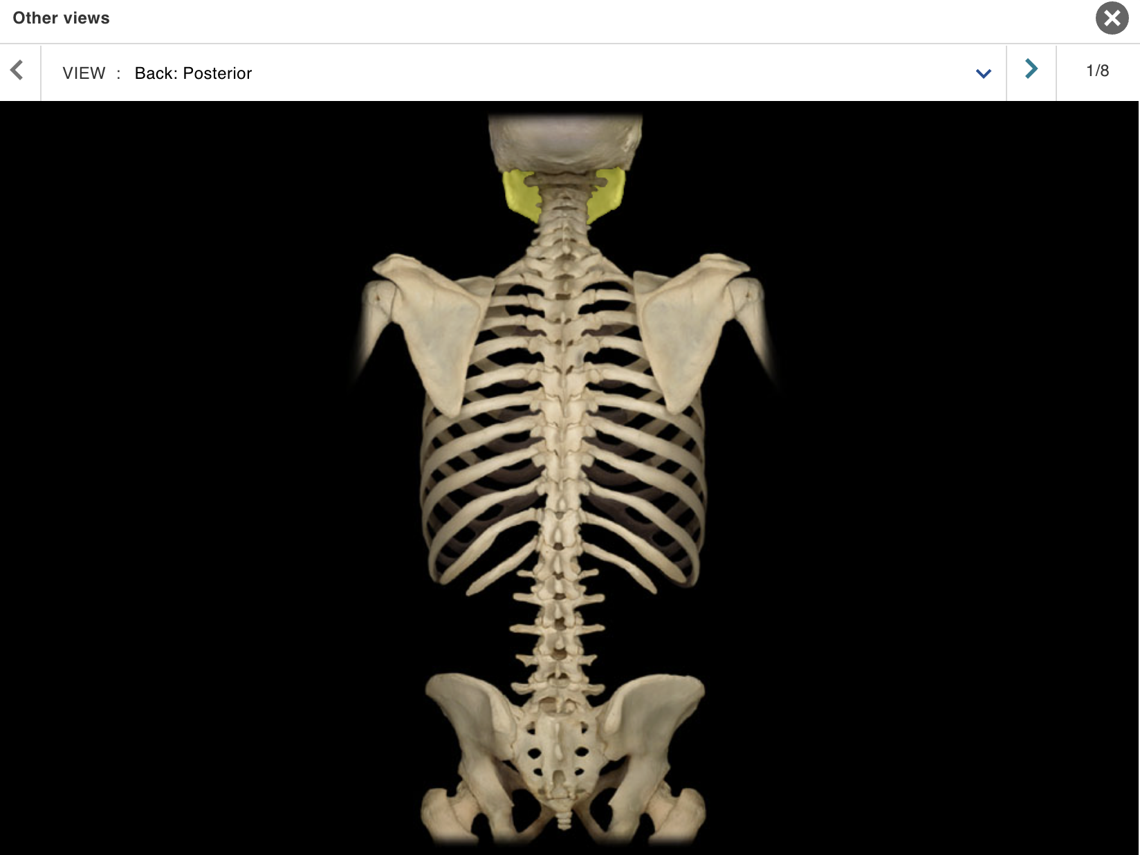 <p>Location:</p><p class="p1">• Skull (anterior)</p><p class="p1">Description:</p><ul><li><p>﻿﻿U-shaped bone</p></li><li><p>﻿﻿Each side consists of body (horizontal) and ramus (vertical) with coronoid and condylar processes</p></li><li><p>﻿﻿Mental protuberance forms point of chin</p></li><li><p>﻿﻿Contains alveoli ("sockets") for teeth</p></li></ul><p>Also known as:</p><p class="p1">• "Lower jaw"</p><p class="p1">Comment:</p><p class="p1">• Contributes to temporomandibular joint (TMJ</p>