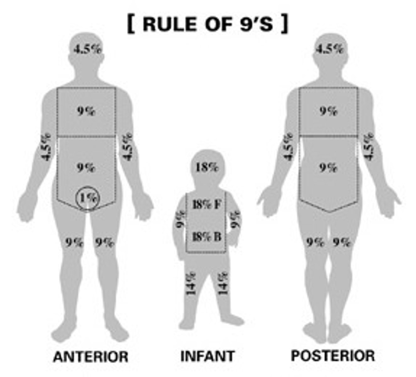 <p>Face= 8.5%</p><p>Posterior head= 8.5%</p><p>Anterior Thorax= 18%</p><p>Posterior Thorax= 18%</p><p>Anterior arm= 4.5%</p><p>Posterior arm= 4.5%</p><p>Anterior leg= 6.5%</p><p>Posterior leg= 6.5%</p><p>Perineum/genitals= 1%</p>
