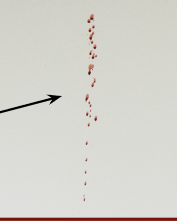 <p>blood thrown from an object in motion</p><ul><li><p>usually straight</p></li><li><p>spatter</p></li></ul><p></p>