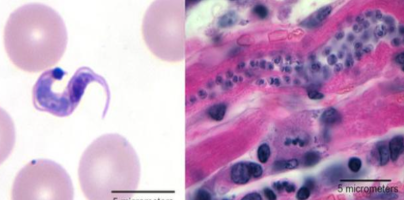 <p>What is the name of this flagellate? State the name of the disease they give to humans.</p>