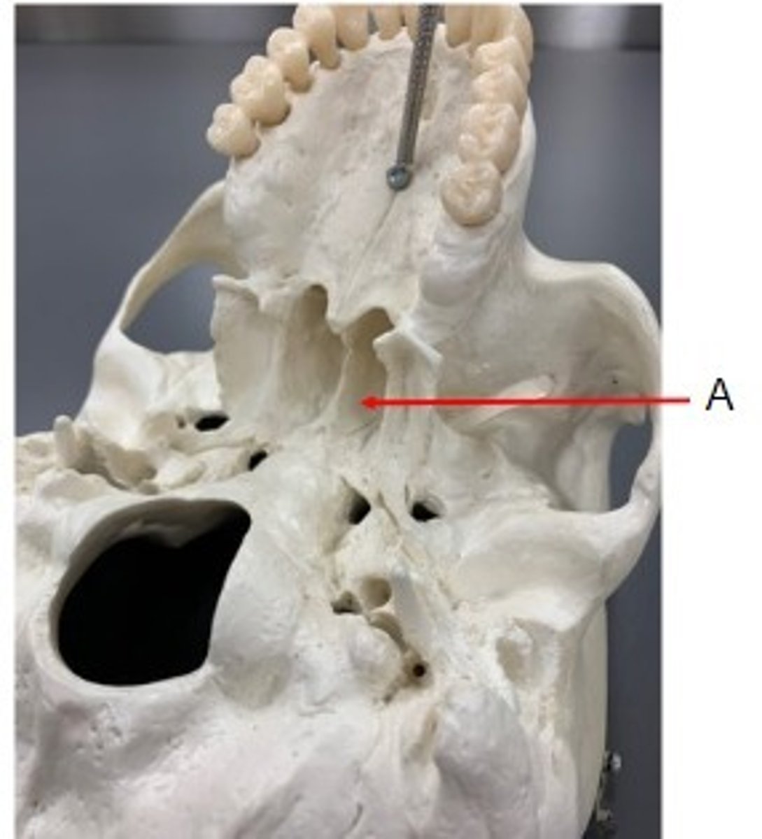 <p>Identify</p>