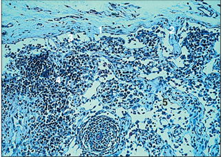 <p>name of histologic slide:</p><p>Specie:</p><p>Parts</p><p>1.__ 2.__ 3.__ 4.__ 5.__</p><p>Stain used:</p>