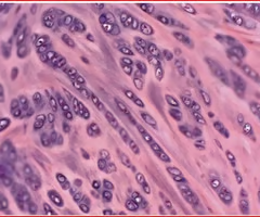 <p>tough due to its thick bundles of collagen fibers dispersed through its matrix</p><ul><li><p>act as a <strong>cushion within joints</strong></p></li></ul><ul><li><p>found in <strong>menisci in the knee joint </strong>and intervertebral discs</p></li></ul><p></p>