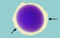 fertilization membrane