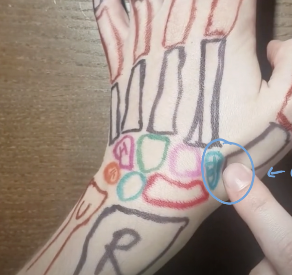 <p>at the base of 1st metacarpal </p>