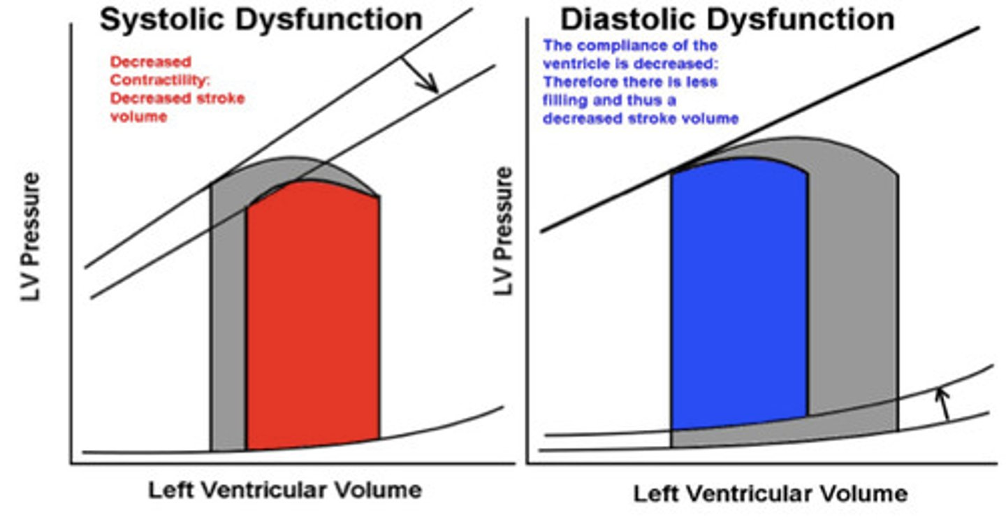 <p>systolic: heart can't pump</p><p>- used to be more common</p><p>diastolic: heart can't fill</p><p>- slightly more common now </p><p>- pretty much seen equally now</p>