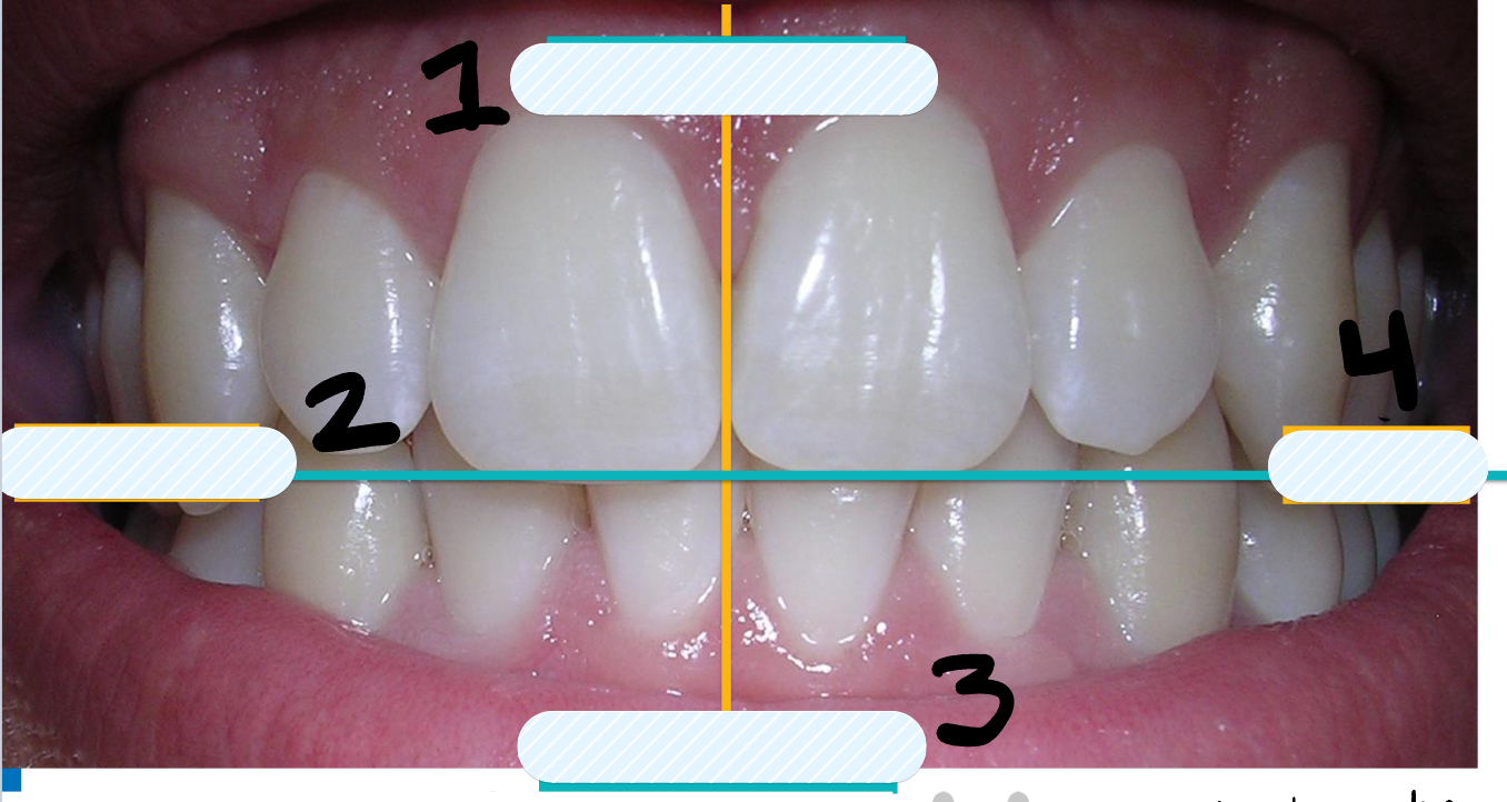 <p>What side is labeled number 2?</p>