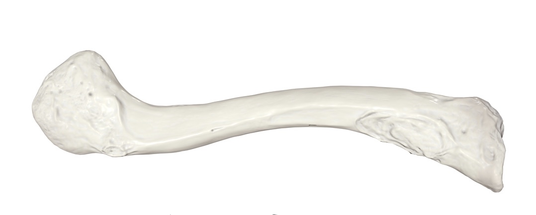 <p>Identify the bone.</p>
