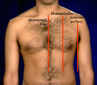 <p>Left of sternum, midclavicular line (line splitting the body from the middle of the clavicle), 5th intercostal space (between 5th and 6th rib)</p>