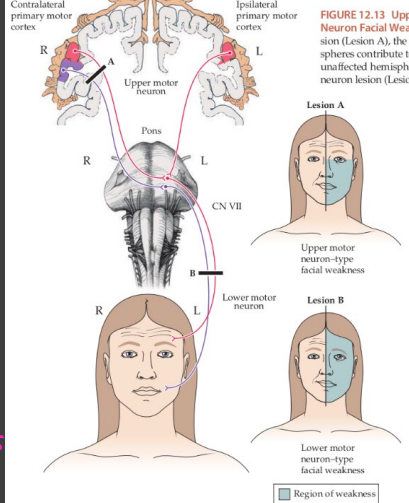 <p><strong>CV VII: Facial Nerve</strong></p><p>-Each facial nerve controls ___________ control of muscles of facial ___________</p><p>-Not involved in eyelid __________</p><p>-Bell palsy vs CNS pattern of facial weakness → ability to _____ eyebrows is spared in strokes </p>