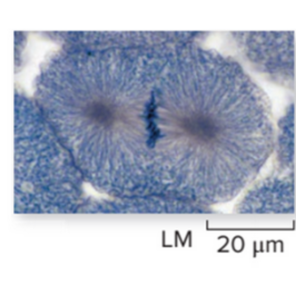 <p>What kind of cell is shown? Name the phase that it is experiencing.</p>