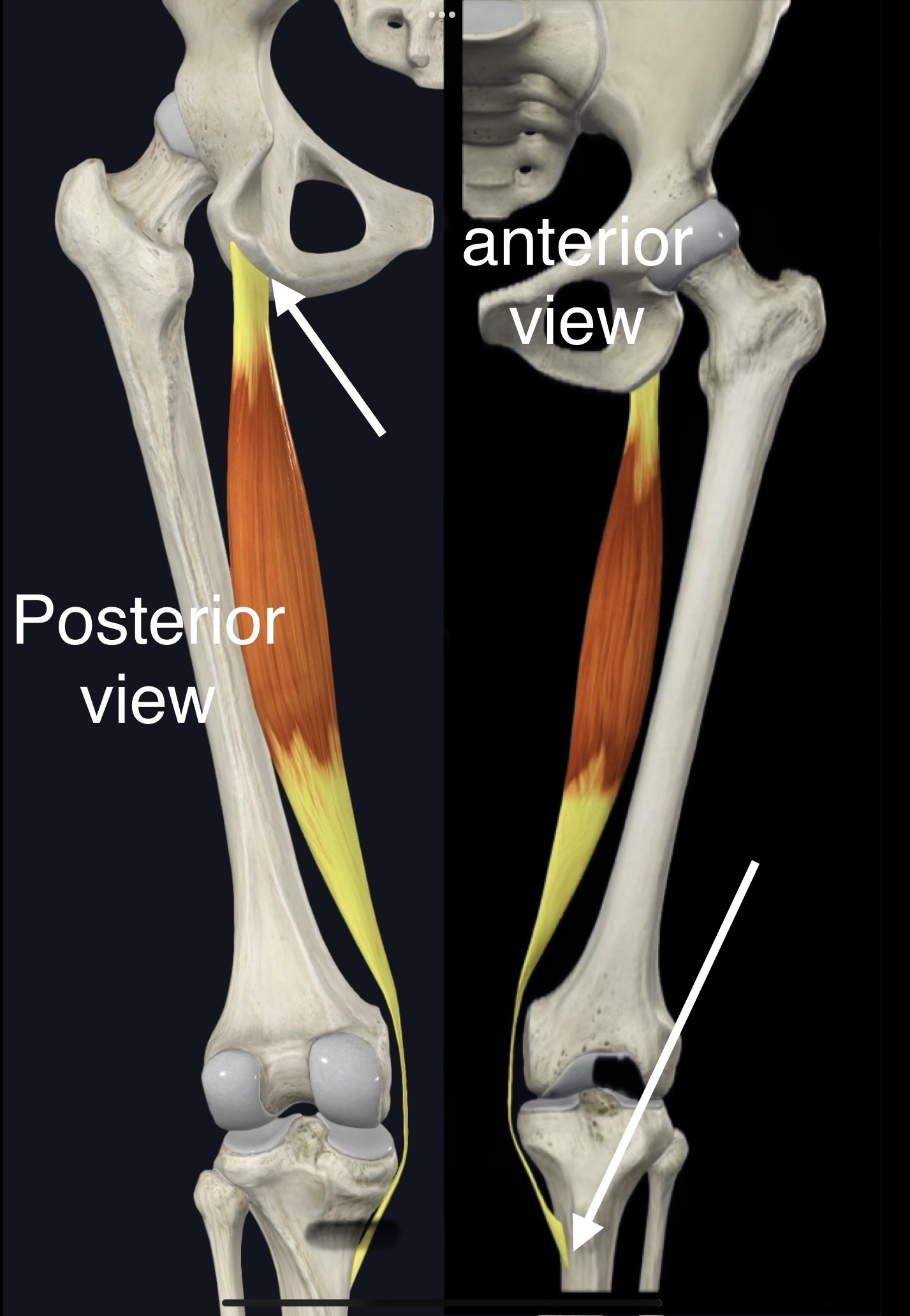 <p>Name the muscle, origin and insertion </p>