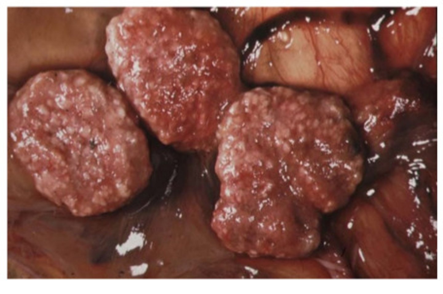 <p>ID the following parasite that would cause white foci of necrosis in the cotyledons of placentas in a herd of ewes</p>