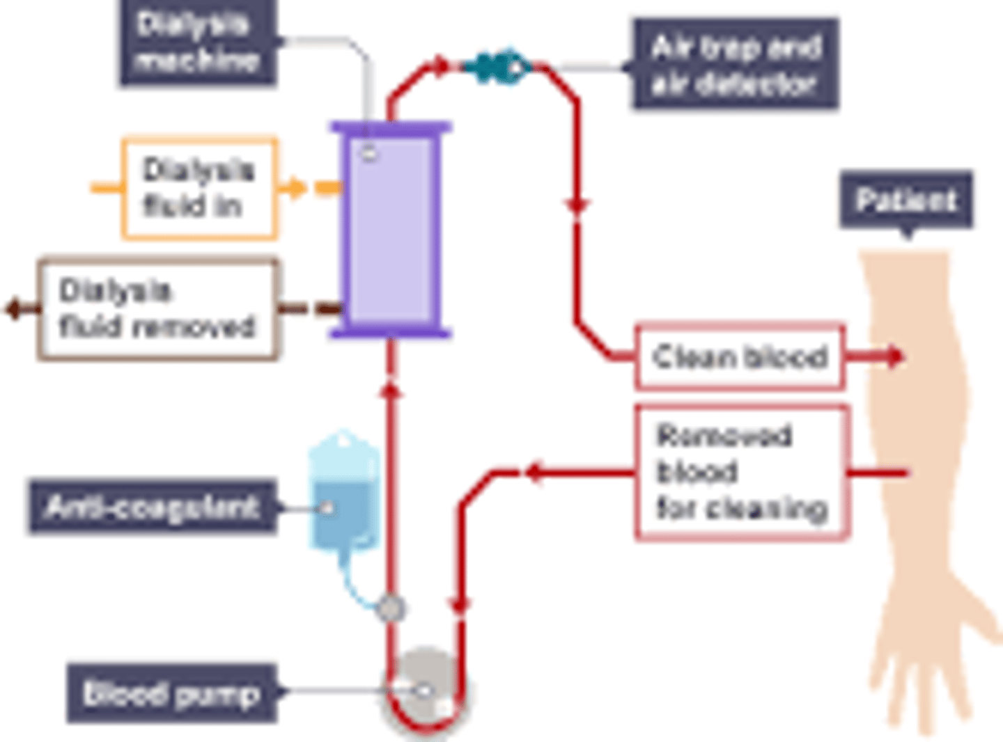 <p>-blood is temporarily removed from the patient's body and filtered through a dialysis machine</p><p>-the patients blood passes through dialysis fluid which has no urea</p><p>-urea and other waste products diffuse from a high concentration in the blood to a low concentration in the fluid</p><p>-patients blood is then returned to the body</p>