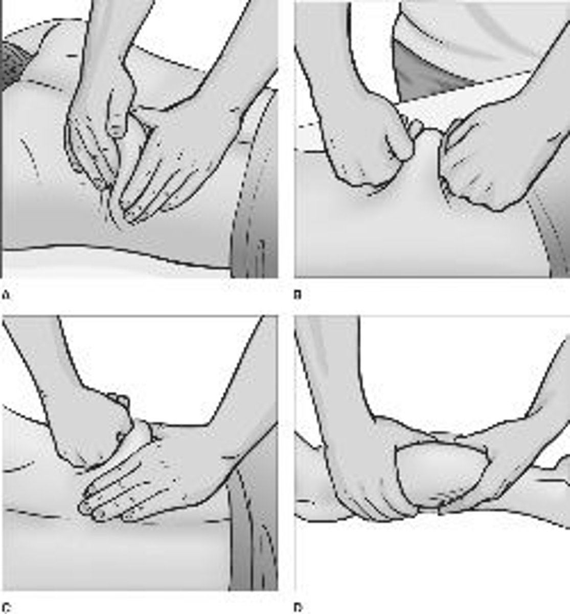 <p>Increasing blood pressure is a reflective effect of what type of treatment technique done on the abdomen?</p>