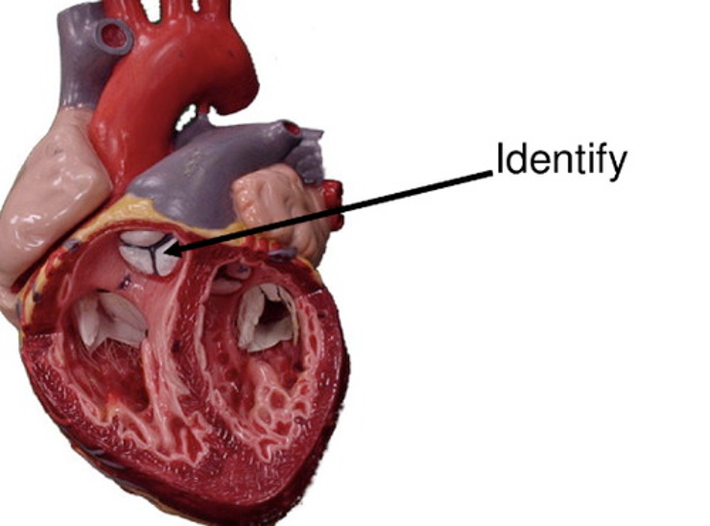 <p>Components; only 1 of the 3 drapes of the pulmonary valve</p><p>H8</p>