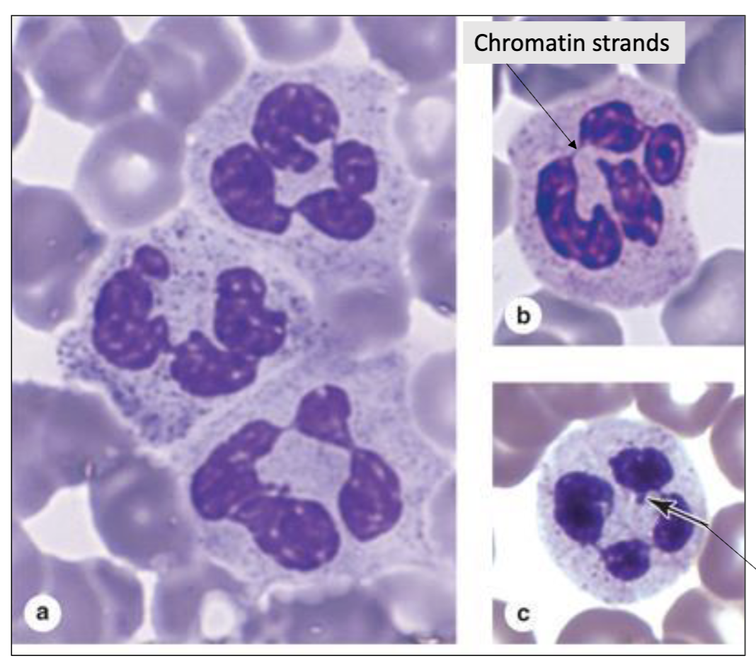 <p>What type of cell is seen here?</p>
