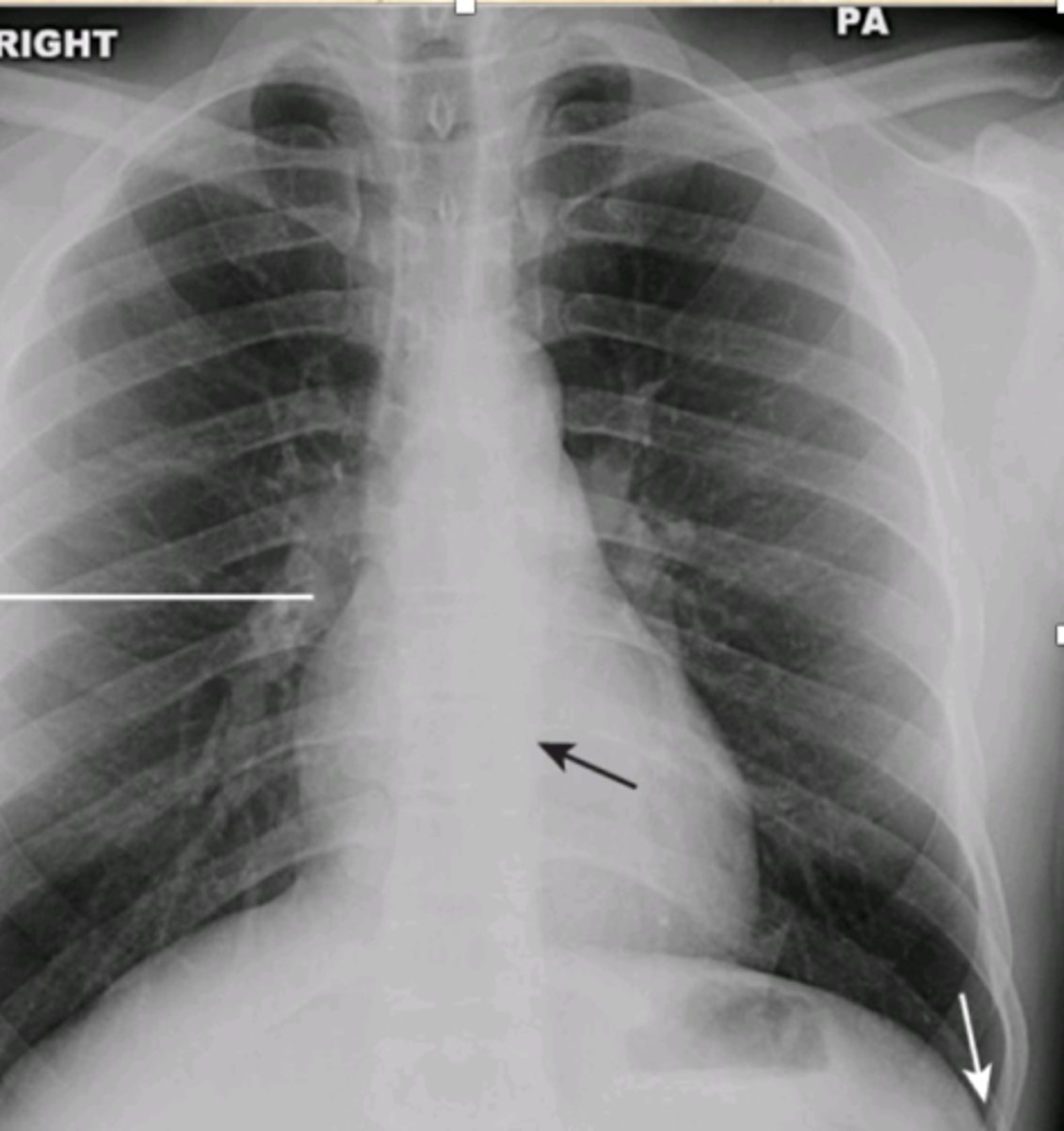 <p>Diagnosis?</p>