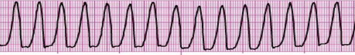 <p>What’s the rhythm?</p>