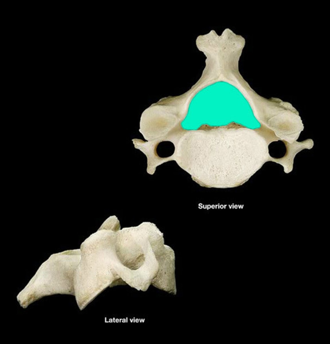 <p>hole in the vertebrae</p>