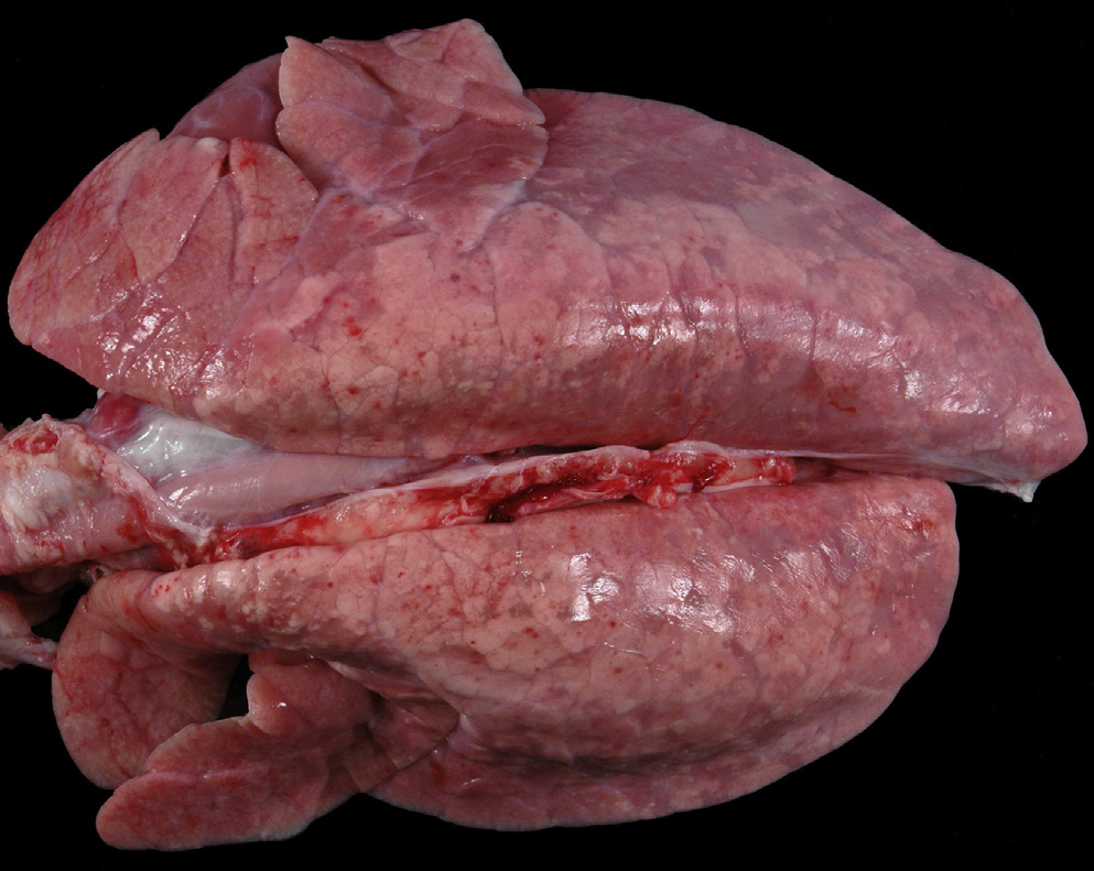 <p>What viral syndrome is likely the etiology for this photo?</p>