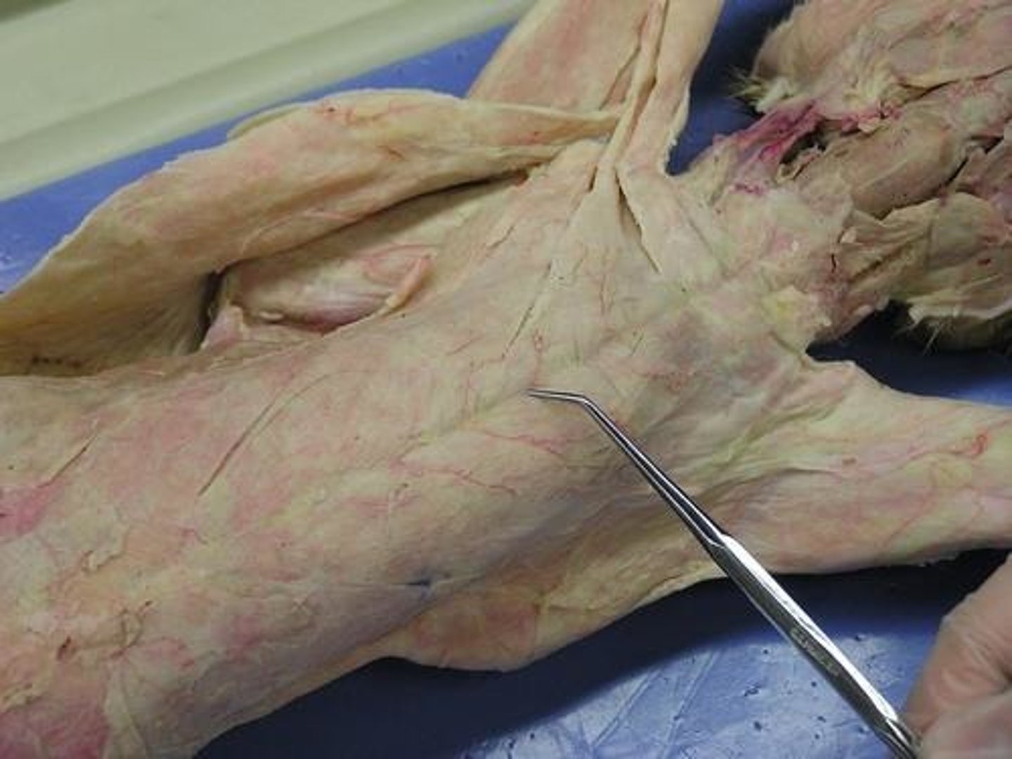 <p>name this muscle</p>