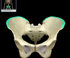 Narrow ridge of bone; usually prominent