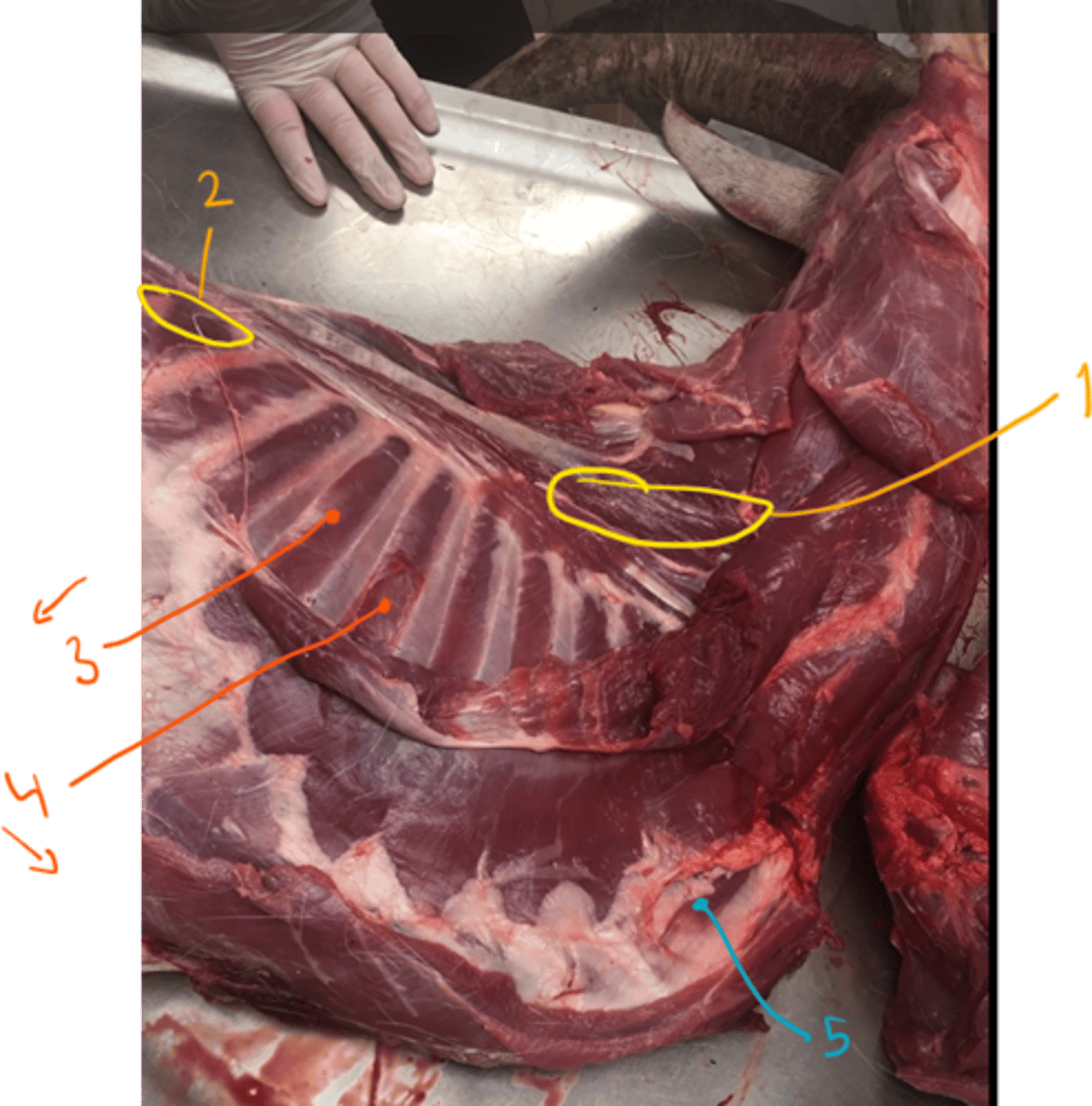 <p>muscles of thorax include what?<br>- what muscles do we not see in the picture of thorax?</p>