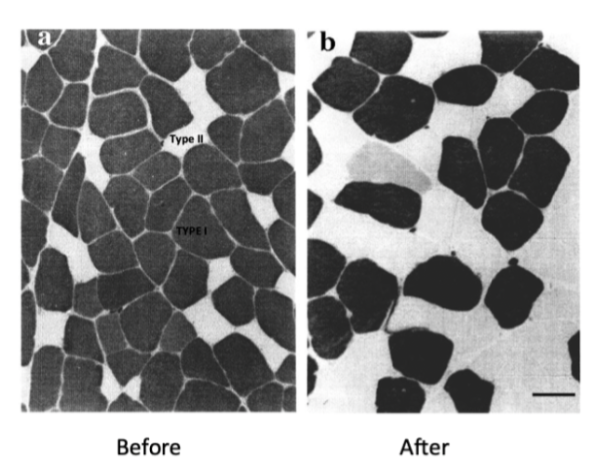 <p>Det sker en hypertrofi av muskelceller, storleken hos de vita muskelcellerna (typ II) ökar. Efter träning ökar <strong>proteinsyntesen</strong> om det finns adekvat näringstillförsel (framförallt protein). Proteinsyntesen efter träning skiljer sig mellan tränade och otränade individer.</p><p>Signalkaskaden som ökar proteinsyntesen medieras av <strong>AKT</strong>. Uppströms kommer<strong> IGF-1</strong> att binda till IGF-1-receptorn. Proteinintag och träning aktiverar direkt <strong>PDK-1</strong>. Transkriptionsfaktorn <strong>mTOR</strong> ökar proteinsyntes, men ifall det inte finns protein tillgängligt aktiveras istället <strong>FoxO</strong> som leder till nedbrytning av proteiner.</p>