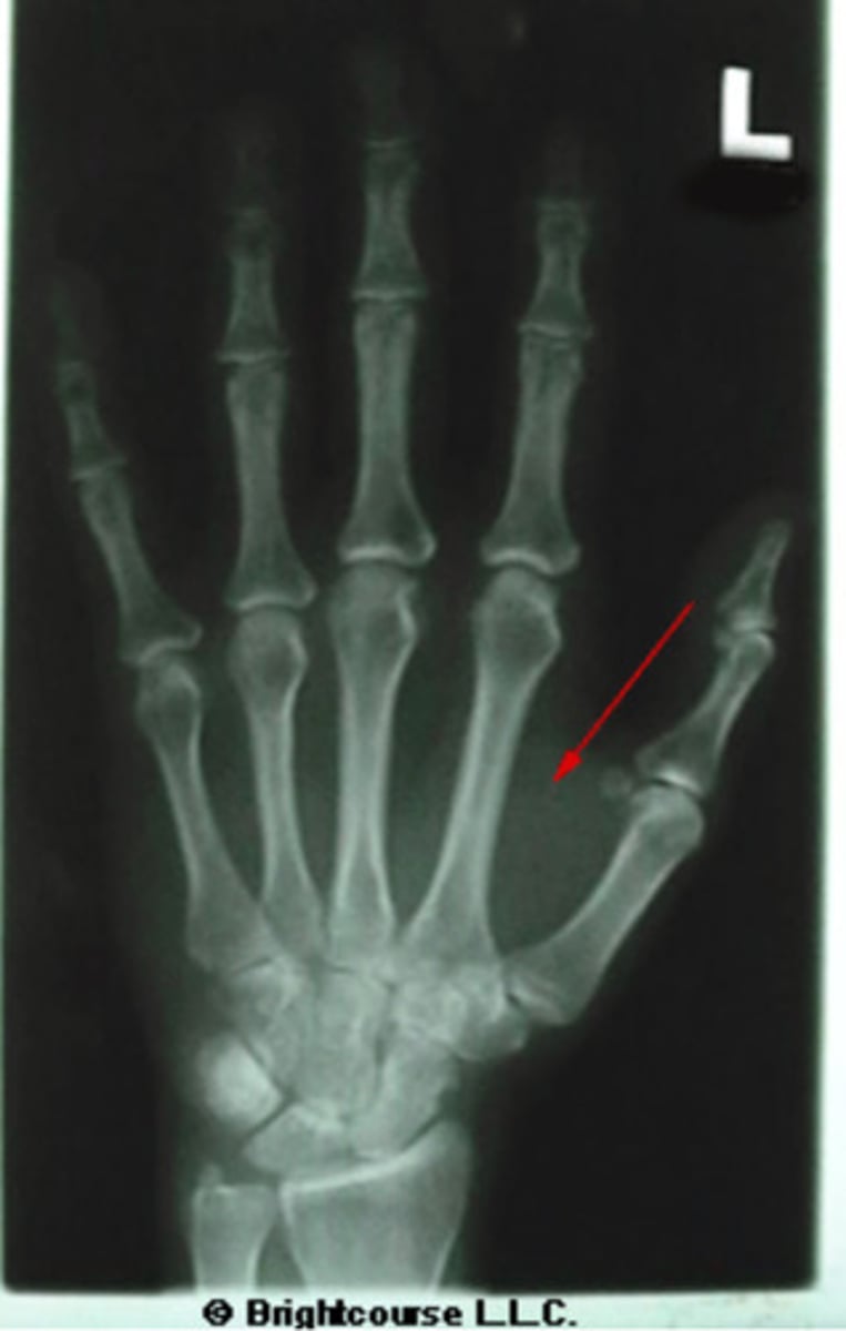 <p>What structure is being pointed out by the arrow?</p>