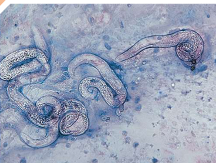 <p>where is <span style="color: rgb(255, 253, 253);"><span>Aelurostrongylus abstrusus located in host </span></span></p>