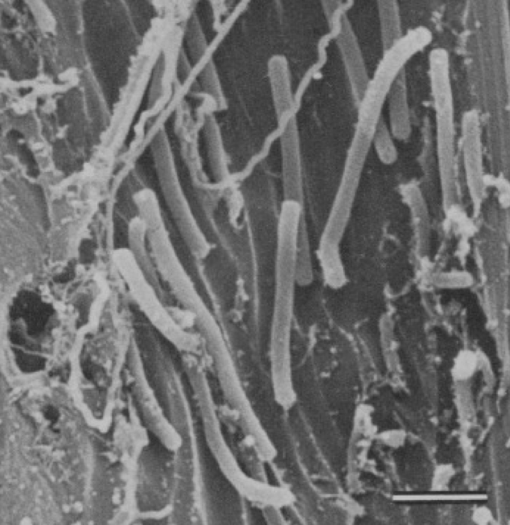 <p>Erosion bacteria</p>