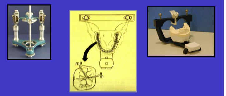 <ul><li><p>have condyles positioned in the correct place and an average value apart from each other</p></li></ul><p></p>