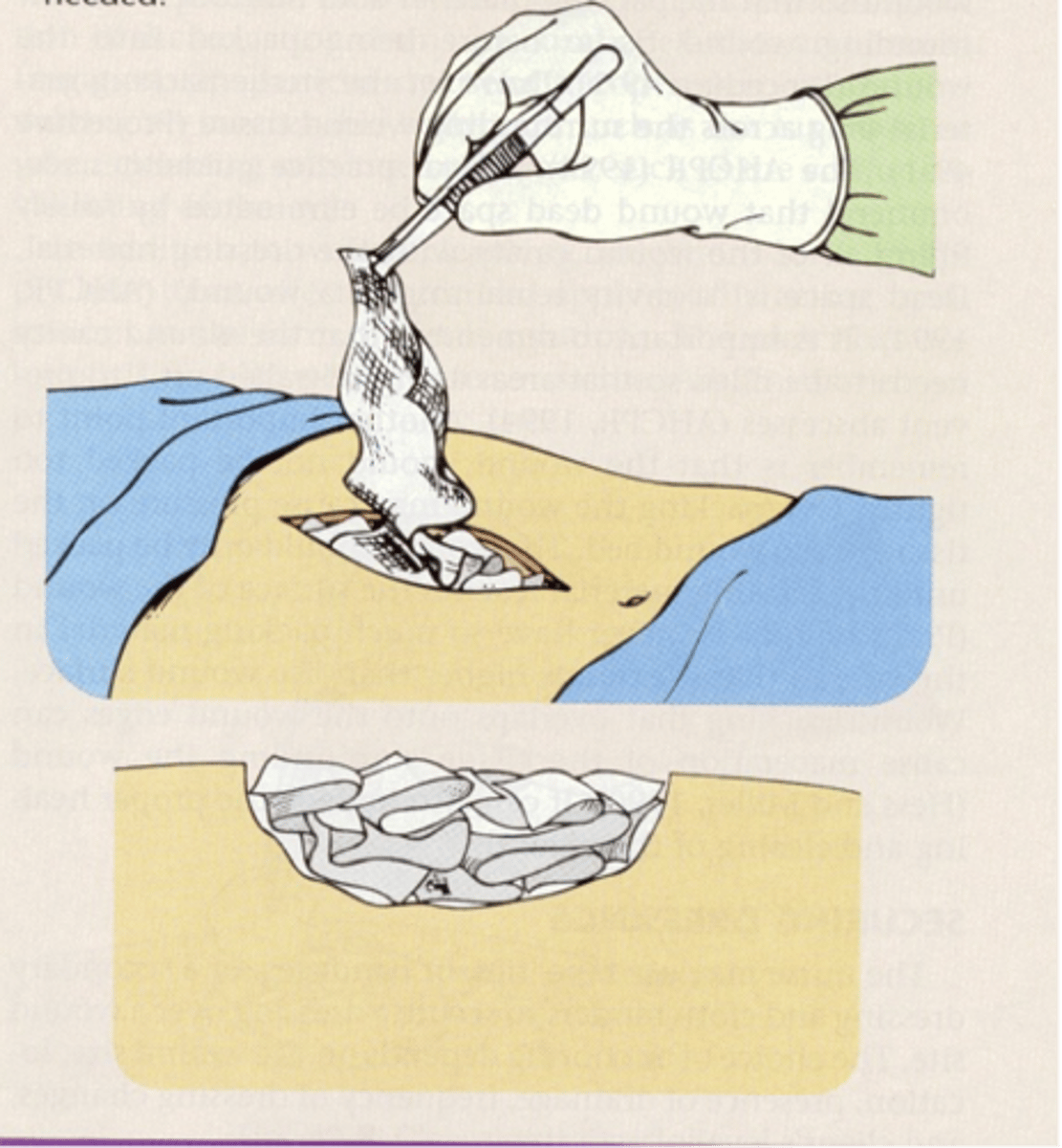 <p>Pack it into a wound and create a tail</p>