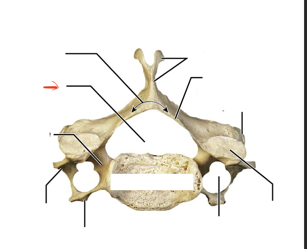 <p>hole posterior to body</p>