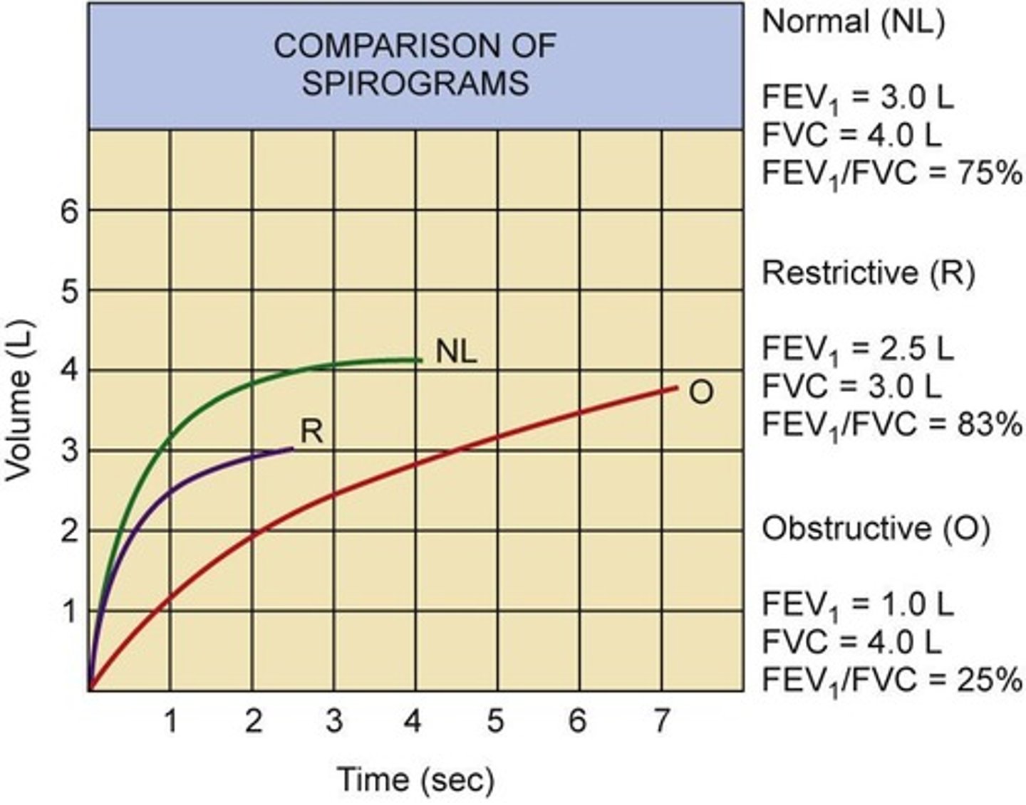 <p>The volume of air exhaled in the first second, serving as a reliable index of obstructive airway disease.</p>