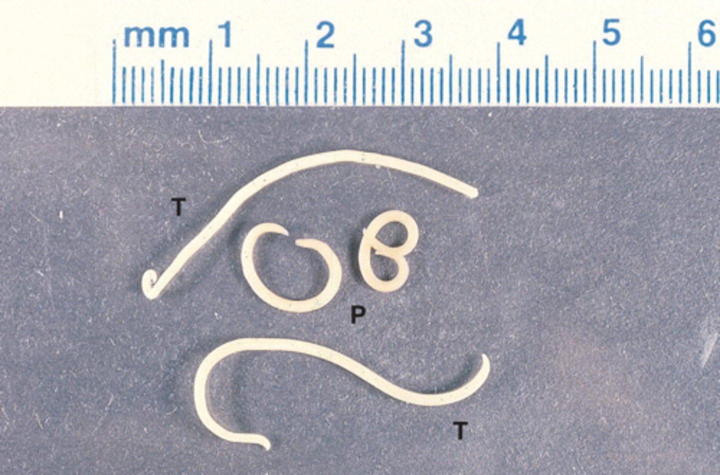 <p>Which parasite is P if it is from a cat</p>