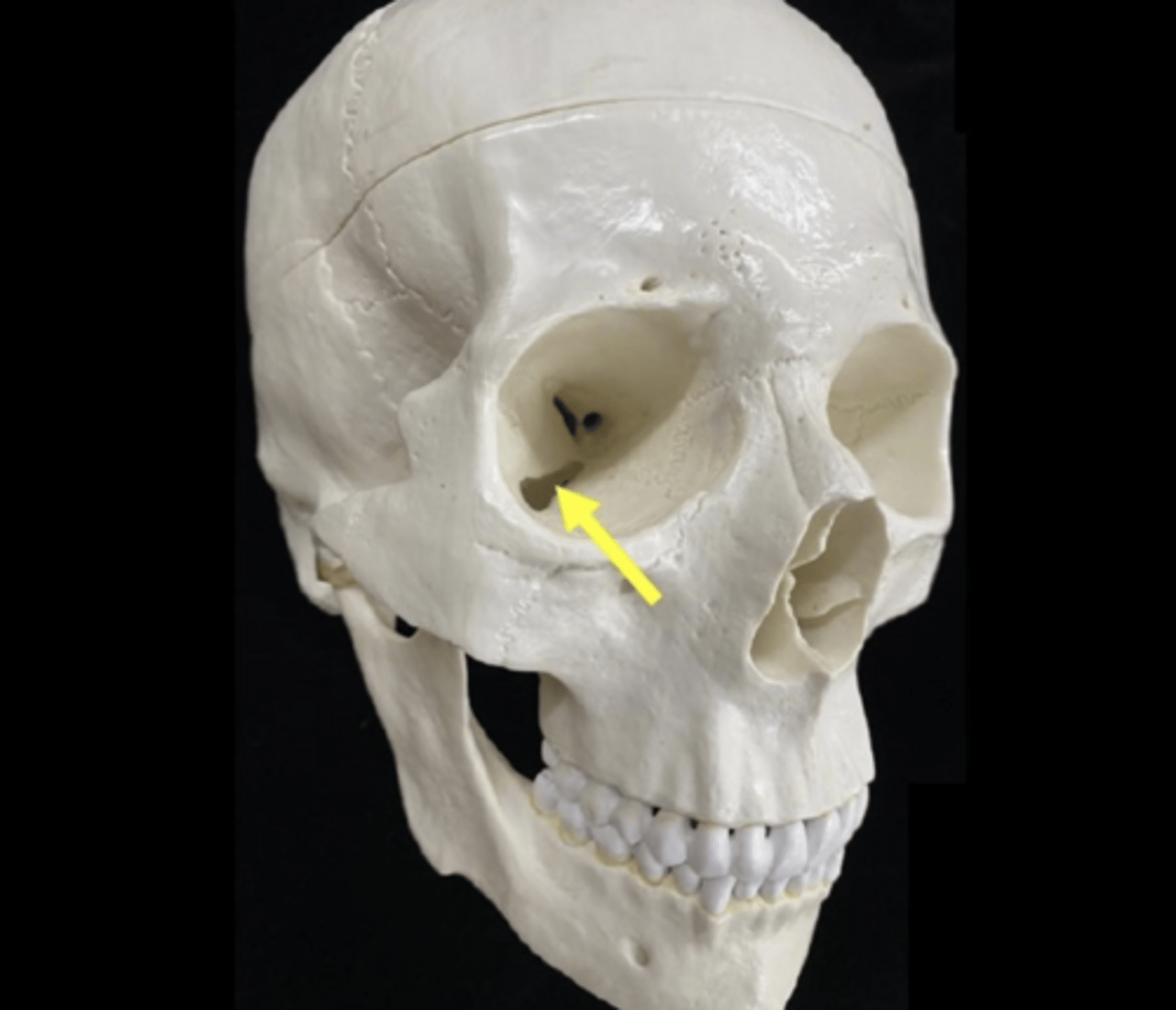 <p>name the bone feature</p>
