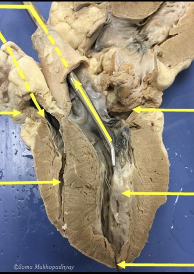 <p>is this the anterior view or posterior view<br>label from top to bottom&nbsp;</p>