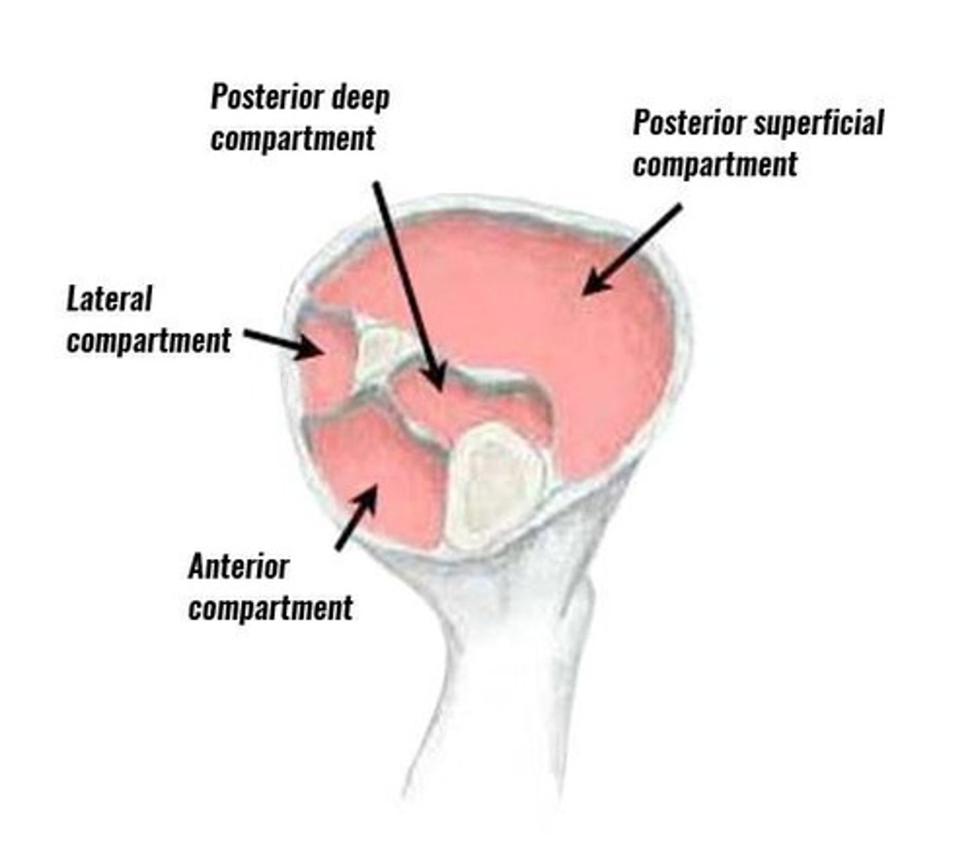 <p>A condition where increased pressure within a compartment compresses nerves and blood supply to muscles, leading to severe pain and potential loss of limb.</p>