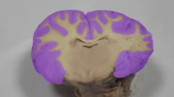 <p>Grey Matter </p>