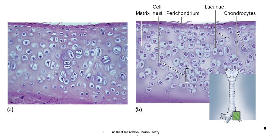<p>location of hyaline cartilage</p>