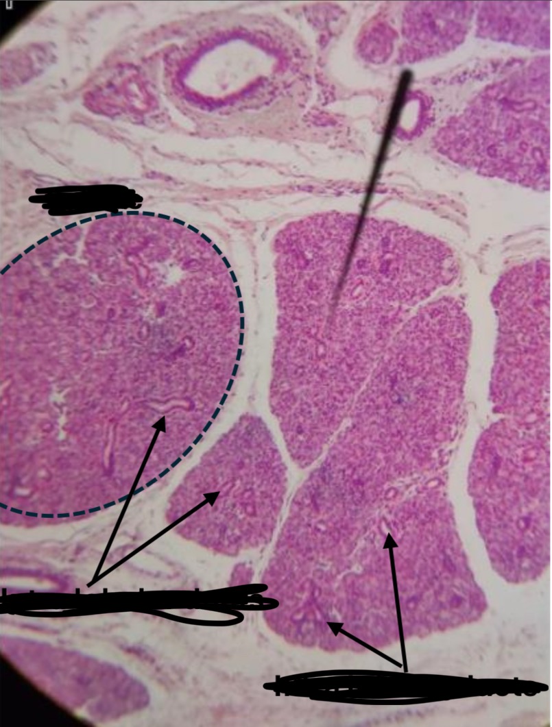 <p>How can you identify the parotid gland?</p>