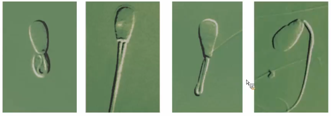 <p>What are some types of tail abnormalities of sperm?</p>