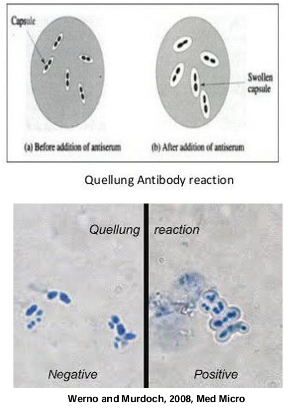 <p>-Add specific antiserum (anti-capsular antibodies) </p><p></p><p>-If S. pneumoniae is present pneumococcal capsule will bind AB causing a microprecipitin reaction on the surface of the Streptococcus pneumoniae (swollen capsule).</p><p></p><p>—&gt; also can occur in klebsiella pneumoniae</p>