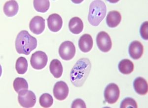 Early schizont plasmodium ovale