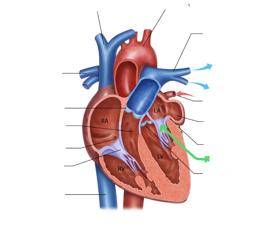 <p>Between left atrium and left ventricle; prevents backflow into left atrium.</p>